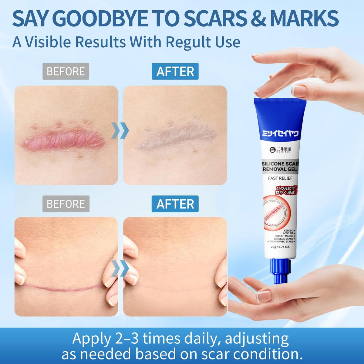 Silicone Scar Removal Gel – Advanced Scar Care Formula