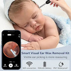 Smart Wireless Ear Cleaner with HD Camera